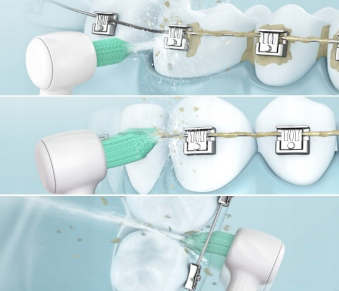 Ирригатор Panasonic EW1313G DentaCare [69900] 