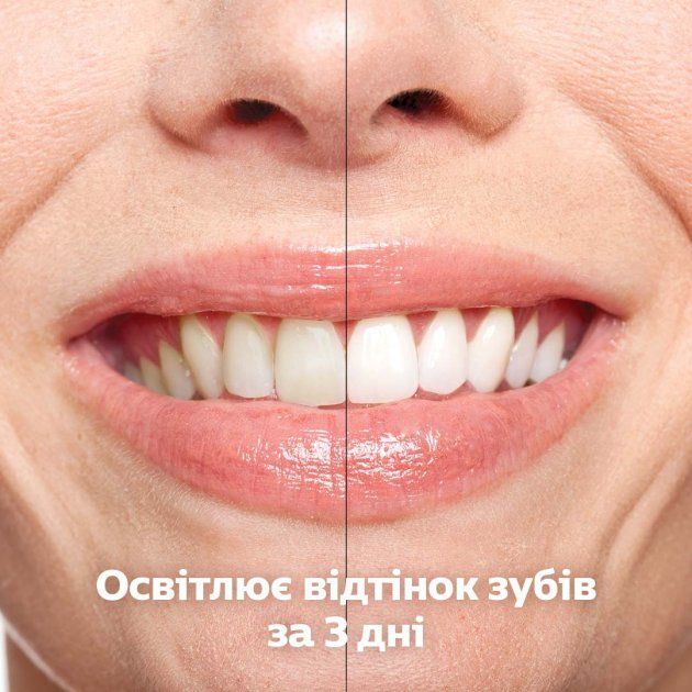 Электрическая зубная щетка Philips Sonicare DiamondClean 9000 (HX9917/88) [70469] 